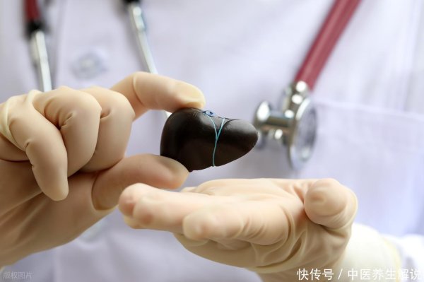 千红网 脂肪肝患者不能吃大蒜？医生提醒：不想肝废掉，这4物尽量远离！